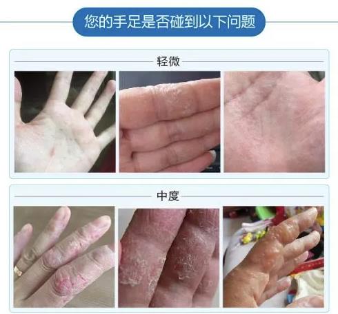 偏门项目：脱皮偏方賺米术，抓住这波机会你也能小赚一笔！